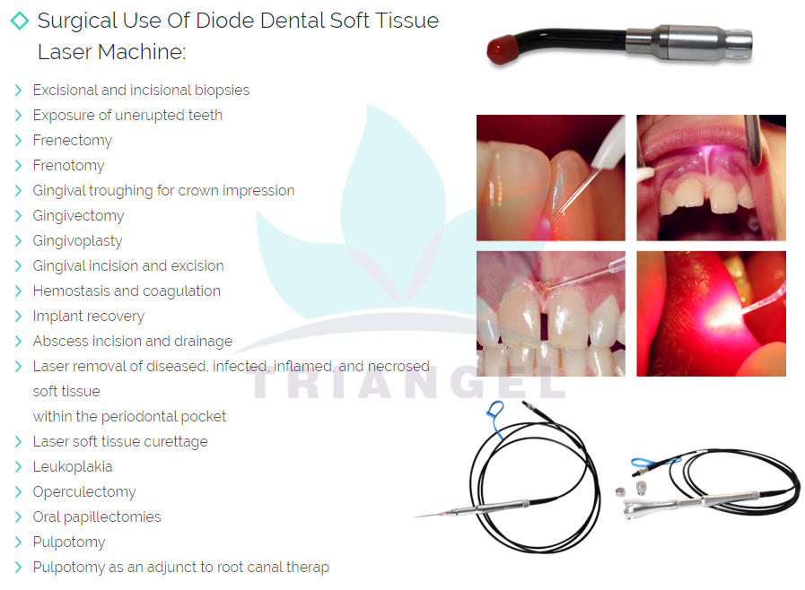láser de diodo dental de 980nm (1)