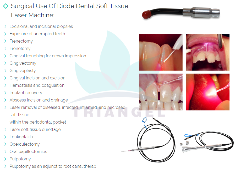 980 nm tandheelkundige diodelaser (1)