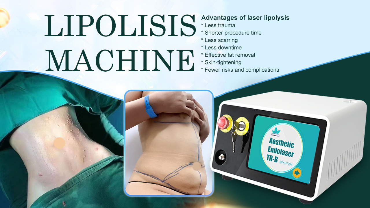 980nm 1470nm laser liposuction