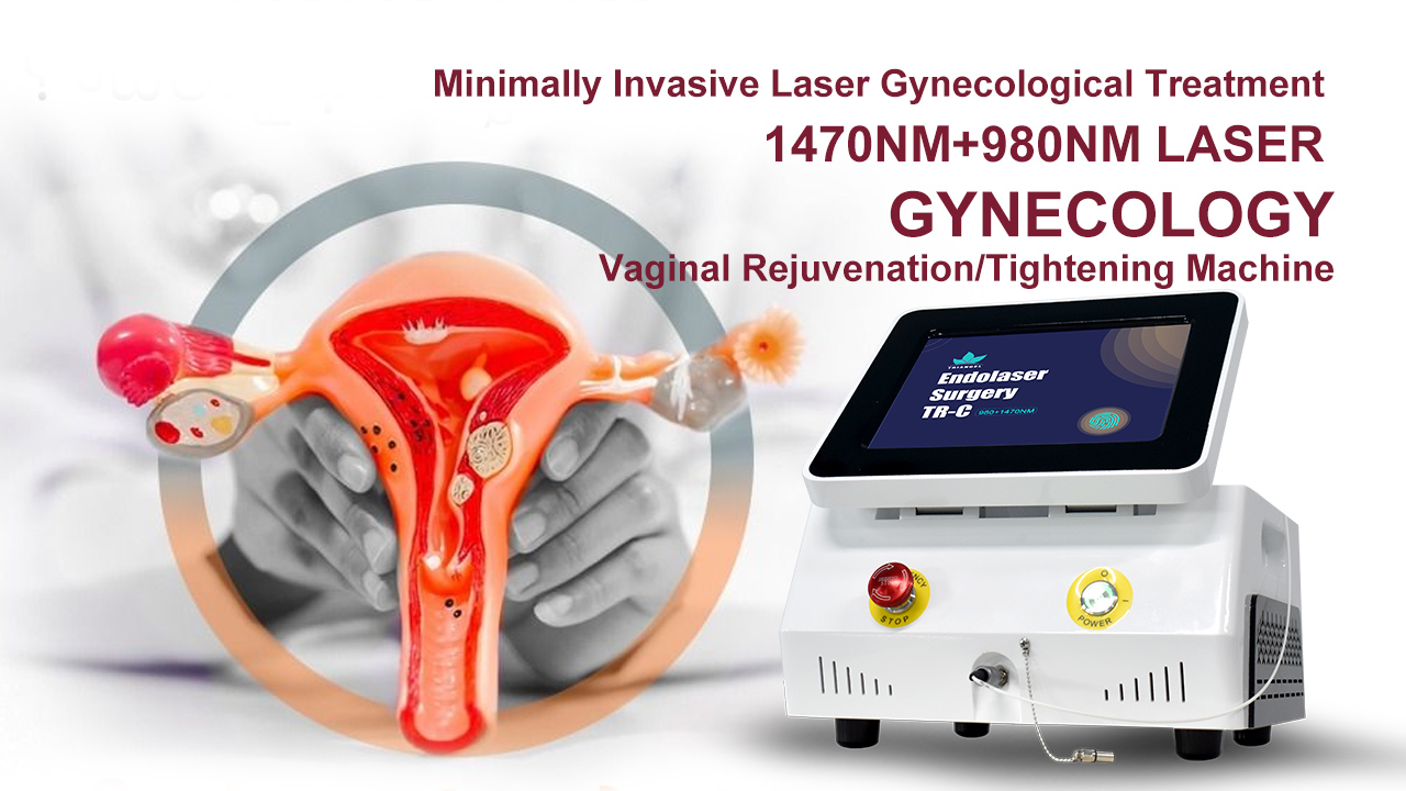 Gynecological Vaginal Tightening Laser
