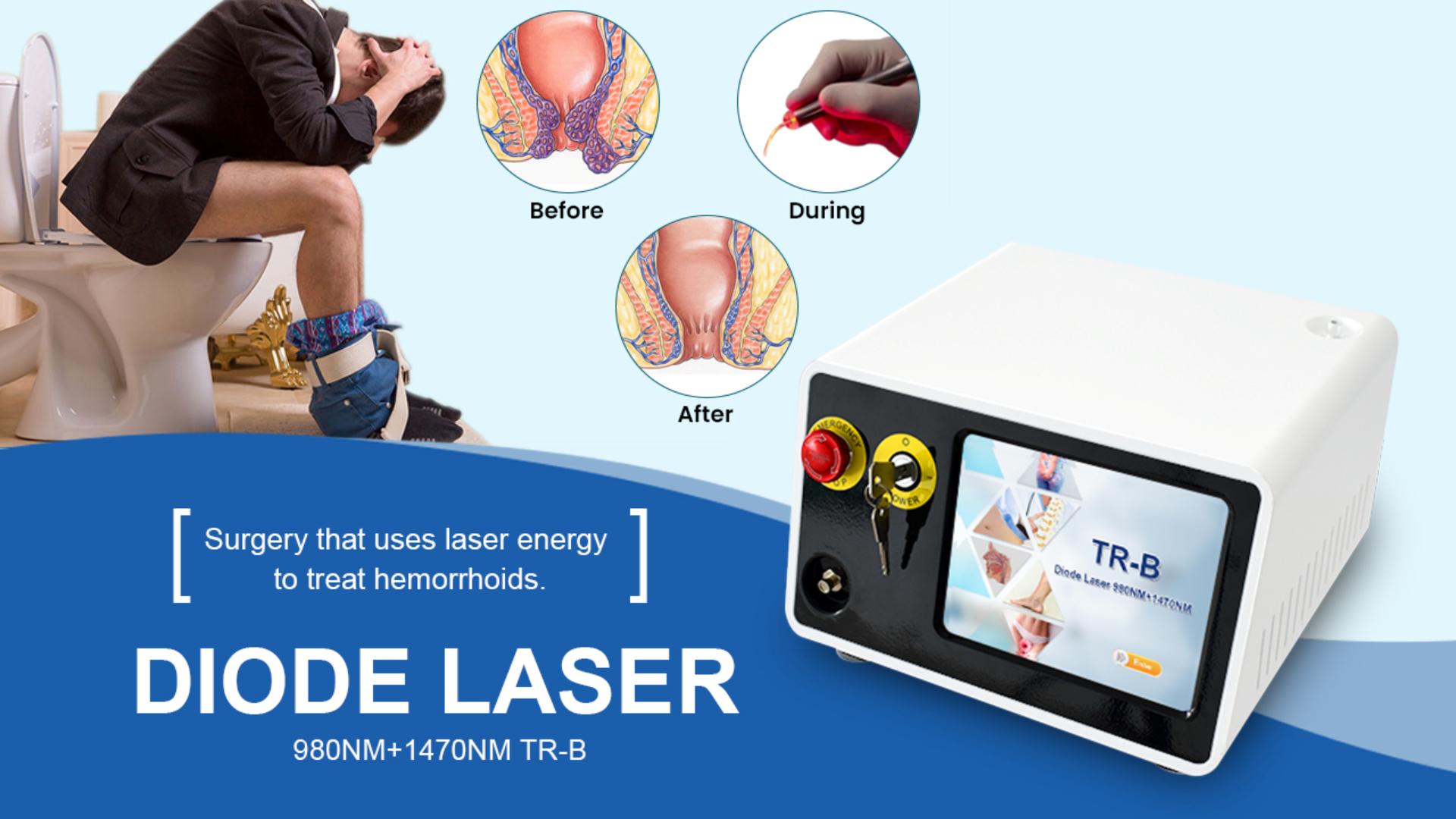 Hemorrhoids TR-B