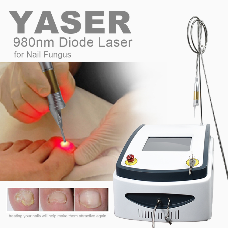 Yaser nail fungus 980nm laser (6)