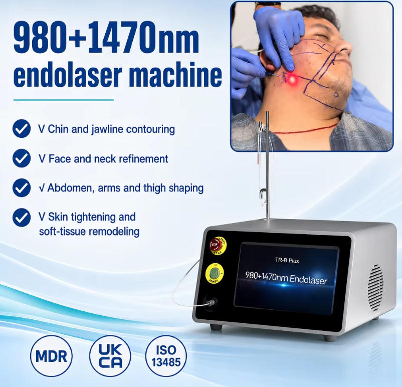 endolaser lift