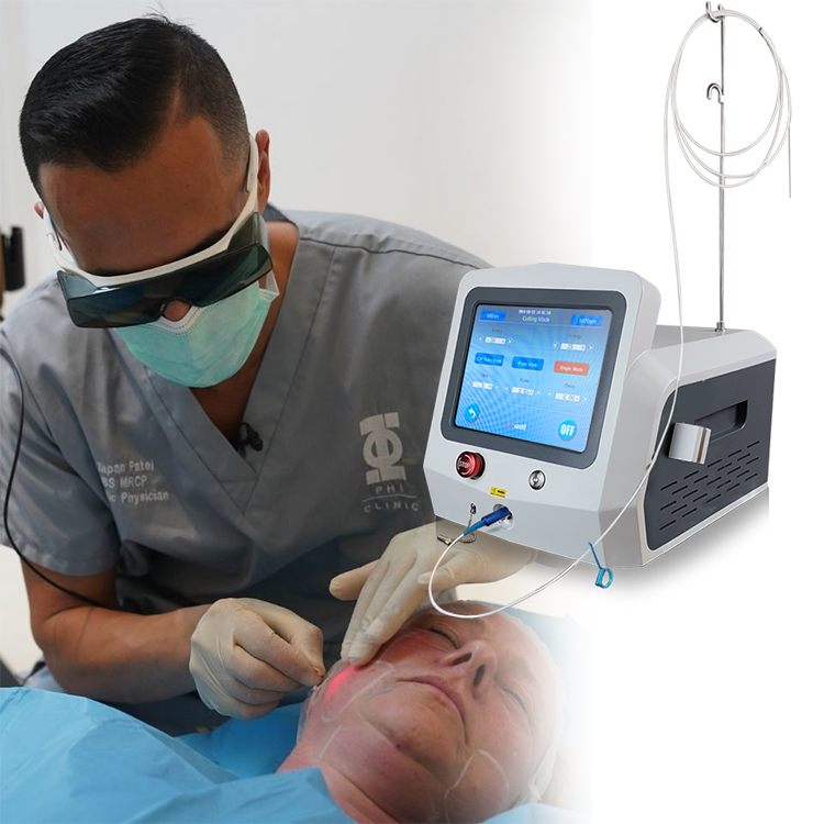 Эндолифт лица фото до и после отзывы China EndoLaser Aesthetics & Plastic Surgery factory and suppliers TRIANGEL